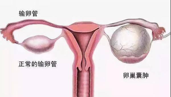 卵巢在肚子哪个位置图图片
